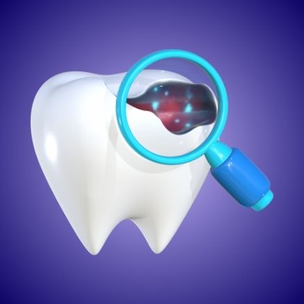 Ritrattamento Endodontico Endodonzia Microscopica