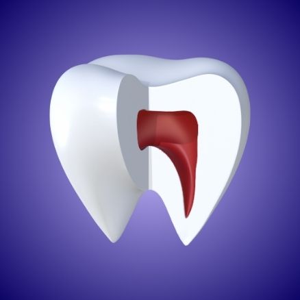 Ritrattamento Endodontico Endodonzia Microscopica