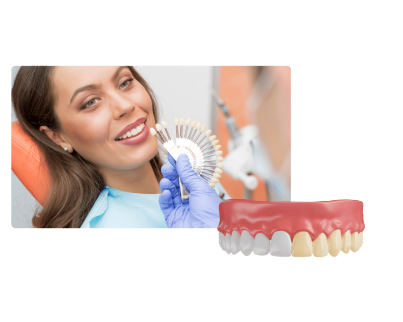 Estetica Dentale