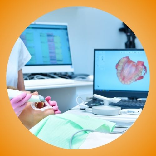 scanner intraorale